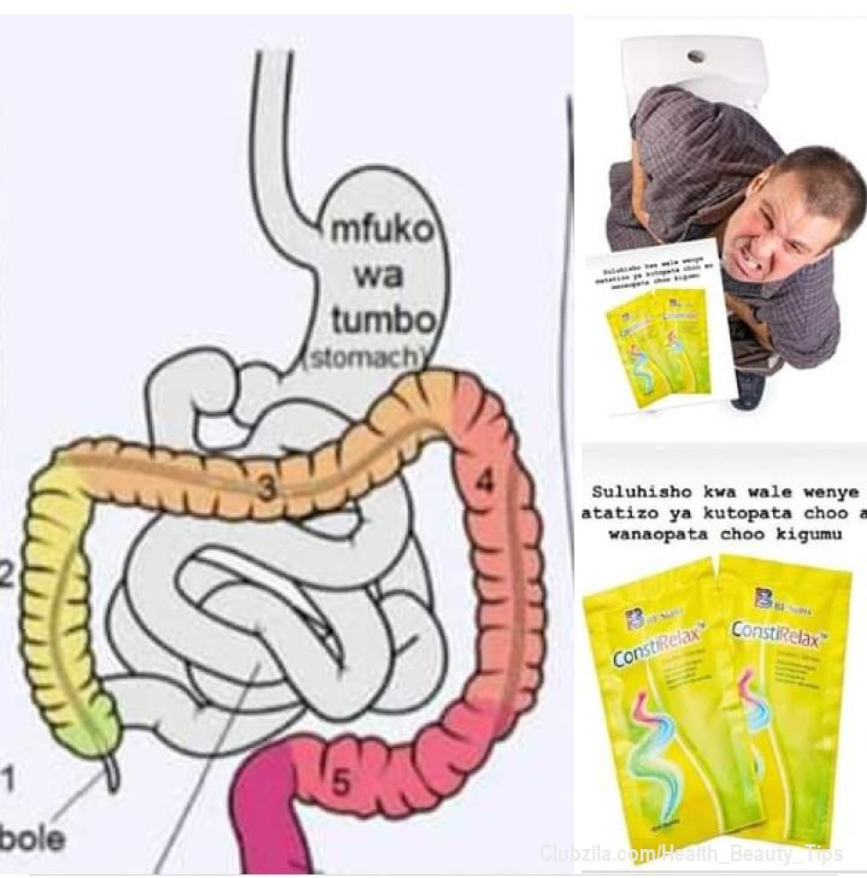KUTOPATA CHOO KWA MUDA MREFU AU KUPATA CHOO KIGUMU - (CONSTIPATION) - SULUHISHO 

"CONSTPATION NI NINI ?

Hili ni Tatizo la kutopata Kwa Muda Mrefu au Kupata Mara Chache
Lakini Kwa Shida Sana na Nguvu Kubwa huwa inatumika Katika Kuhakikisha Walau hicho Kidogo Kinatoka , Kwa Sababu Ya Choo hicho Kuwa Kwenye Muundo Kama tope Jeusi au Vipande Vipande Kama Cha Mbuzi na Kwa Kiwango Kikubwa Kinatawaliwa na Miungurumo isiyokwisha tumboni na Hewa Nyingi Wakati wa Kwenda haja ( Kujamba Sana ) Inayoambatana na Harufu Kali Sana.

CHANZO CHA CONSTIPATION NI NINI ?

Constipation inasababishwa na mfumo mbovu wa mmeng'enyo wa chakula
Kwenye utumbo mdogo ambao una urefu wa takribani mara 10 mpaka 13 ya urefu wa mtu husika , Kwenye Utumbo huo kuna Villars , hivi ni kama vidole ambavyo muda Wote huwa vinachezacheza ili kumeng'enya chakula , 

Ila kutokana na sumu tunazoingiza mwilini kila siku kutoka kwenye vinywaji , Chakula , Dawa , Hewa tunzovuta Pamoja na Mafuta tunayokula kwenye vyakula huwa Viaenda kujipachika katikati ya Villars (vidole) na hivyo kusababisha vidole visimame (blocked) 

hivyo chakula Kinakuwa hakimeng'enywi na kusababisha chakula tunachokula kupitiliza moja kwa moja kwenye utumbo mkubwa Kama Kilivyo na hapo ndio tatizo linapoanzia.

Tatizo hili la Constipation hupelekea Watu kupata Magonjwa Mengi na Kusababisha Vifo Vingi Sana Kwa Watu Mbali Mbali Mbali na Wengine Bila Kufahamu Chanzo Cha Magonjwa Waliyonayo - Hata Baada ya Vipimo Vya Kimaabala .

Kama Unapata Choo Mara Moja(1) Kwa SIKU Na Unakula Mara Tatu (3) Upo Kwenye Hatari Kubwa Ya Kupata Magonjwa Yafuatayo:

~Kansa ya Utumbo.
~Uzito uliozidi.
~Bawasir i(Vinyama sehemu ya haja kubwa).
~Maumivu ya Kiuno , Mgongo , Mabega , Kichwa , Misuli.
~Kukosa usingizi(Insomnia)
~Kukosa hamu ya kula (Loss of appetite).
~Tumbo kujaa gesi.
~Vidonda vya tumbo (Ulcers).
~Upungufu wa nguvu za kiume.
~Kushindwa kubeba mimba au kuzaa ( Ugumba ).
~Kupasuka kwa utumbo.
~Ileocecal valve incompetence.
~Kutoa harufu mbaya mdomoni na unapojamba.
~ Msongamano wa Hewa Kwenye Mapafu ( Kubanwa Mbavu na Kukosa Pumzi).
~ Maumivu ya tumbo Mara kwa Mara.
~ Muwasho Njia ya Haja Kubwa .
~ Maumivu ya Koromeo ( Kuhisi Kitu Kinapanda Kooni na Kushuka ).
~ Kiungulia .
~ Magonjwa ya Ngozi.

Na Mengine Mengi Sana.